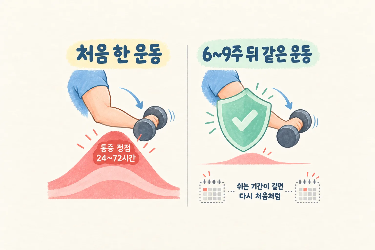 첫 번째 신장성 운동 뒤 큰 통증 물결과 같은 운동을 6~9주 뒤 다시 했을 때 방패에 막혀 작아진 통증 물결을 좌우로 비교한 도해